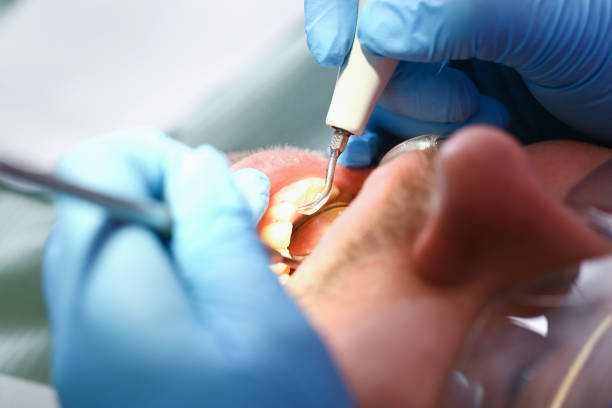 Best Urgent Dental Care for Toothache in De Leon, TX